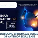 Webinaire-Vidéo:  La chirurgie endoscopique de l’étage antérieur de la base du crâne